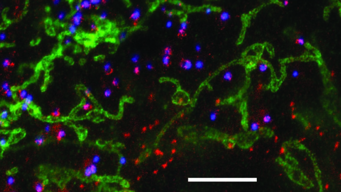 STED-Mikroskopie-Aufnahme von Fibroblastenzellen. Der weiße Balken ist fünf Mikrometer lang.