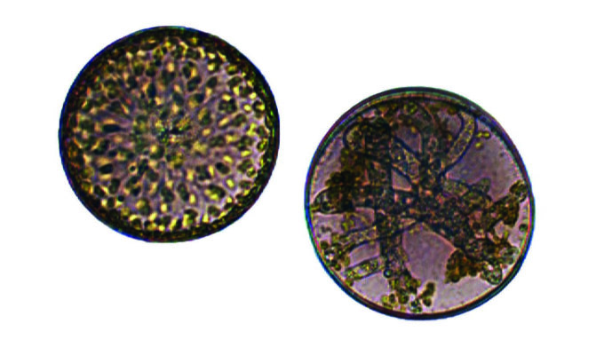Healthy diatom (left) and infected  diatom (right): The parasitic oomycete  Lagenisma coscinodisci sucks all nutrients from the infected cell and manipulates the algal metabolism to form its own form of reproduction—a sporangium.