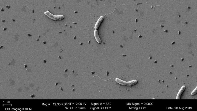 Elektronenmikroskopische Aufnahme des Cholera-Erregers (vibrio cholerae).