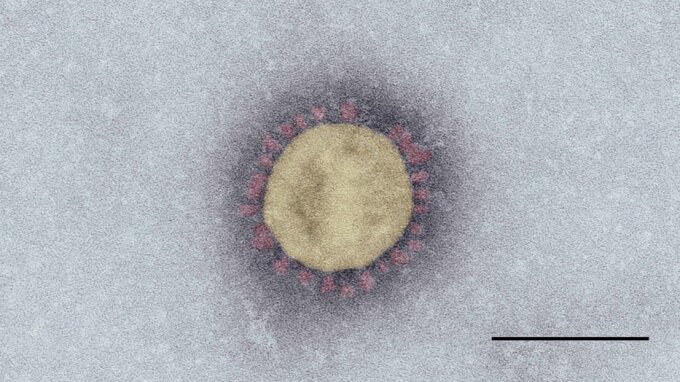Elektronenmikroskopische Aufnahme eines SARS-Coronavirus-2. Maßstab: 100 nm.
