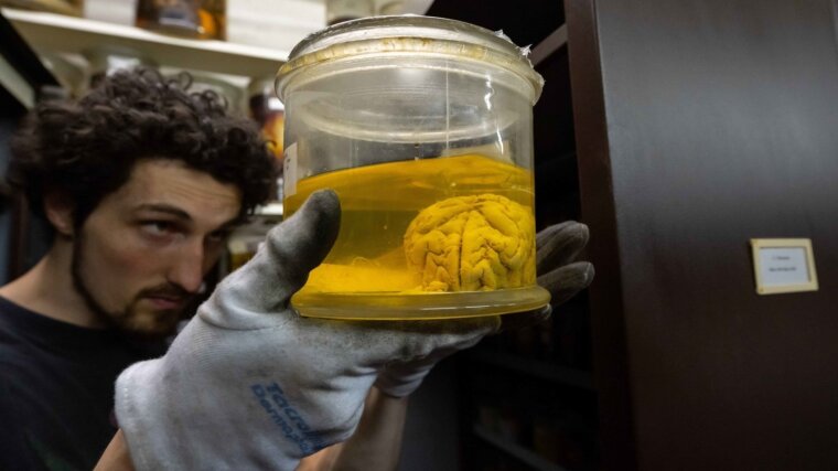 Bernhard Bock inspiziert das konservierte Gehirn eines Primaten, bevor es in die Umzugskiste kommt.