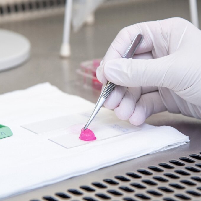 New 3D skin infection model tests the efficacy of antimicrobial wound healing products.