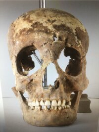 The forensic expert restructures the dead man’s face.