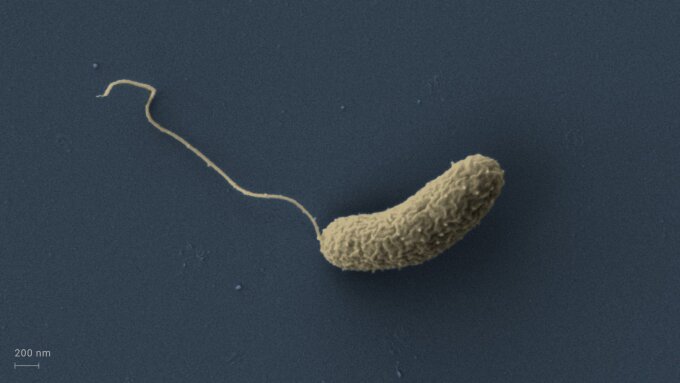 Small RNA and protein molecules regulate the metabolism and toxin production of cholera bacteria.
