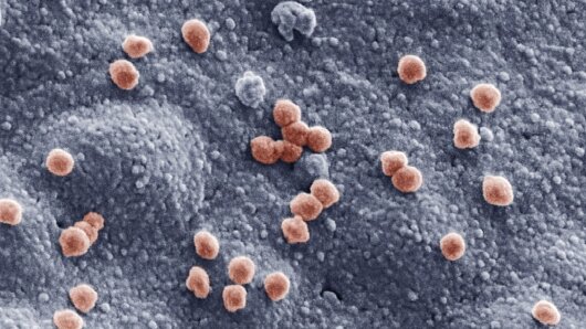Coloured scanning electron microscope image of SARS-CoV-2 viruses (red) on the surface of a human lung cell (blue) examined in a laboratory experiment.