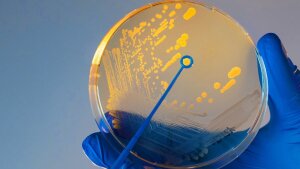 A hand with a blue rubber glove holds a petri dish with Vibrio cholerae bacteria.
