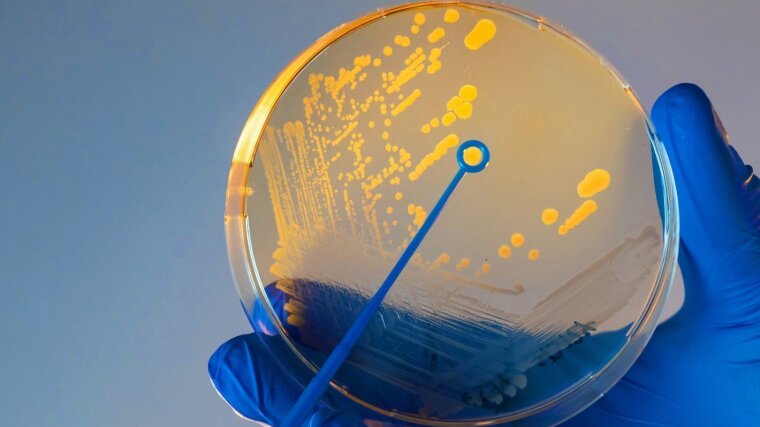 A hand with a blue rubber glove holds a petri dish with Vibrio cholerae bacteria.