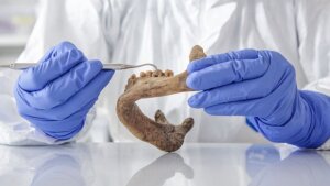 Prehistoric dental calculus is being analysed in the laboratory.