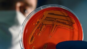 Eine Person hält eine Petrischale mit Bakterienkulturen (Staphylococcus aureus).