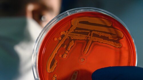 Eine Person hält eine Petrischale mit Bakterienkulturen (Staphylococcus aureus).